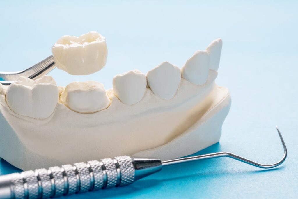 Closeup / prosthodontics or prosthetic / single teeth crown and bridge equipment model express fix restoration